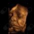 Nicolay Enrico Narvaez Restrepo