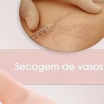 Nilo Mandelli, Angiologista Porto Alegre