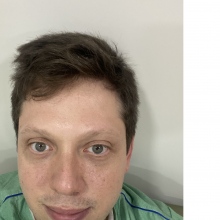 Bruno Bonder, Ortopedista - Traumatologista São Paulo
