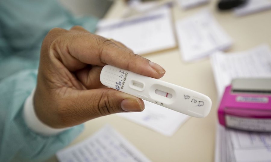 Testes covid breno esaki ag sa%c3%9ade df