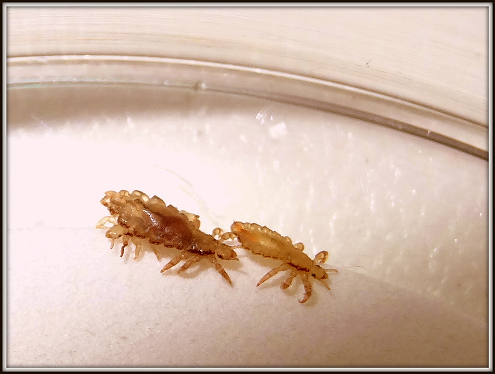 piojos pediculosis