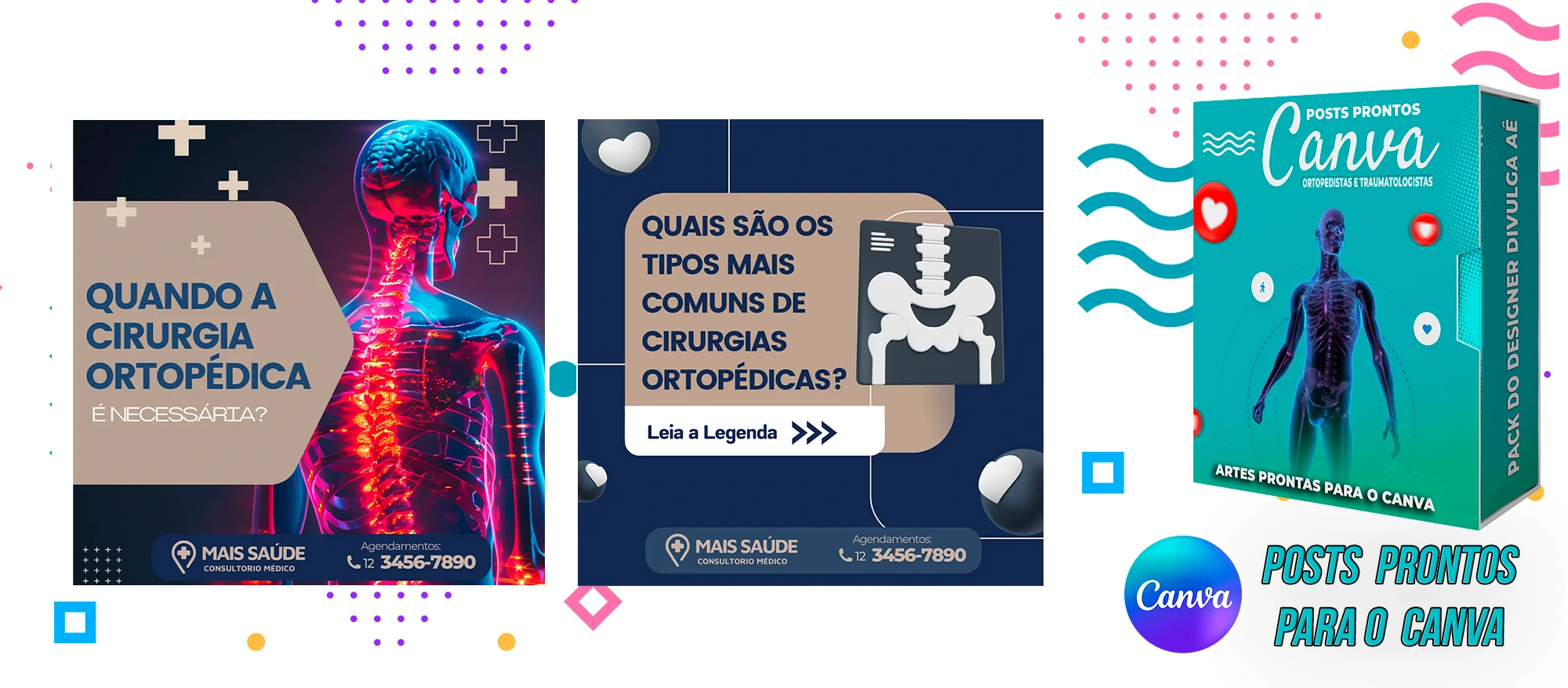 Pack de Posts Prontos com legendas para Ortopedistas e Clínica Ortopédica no Canva - Imagem 17