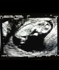 Francisco Román Torres Huerta