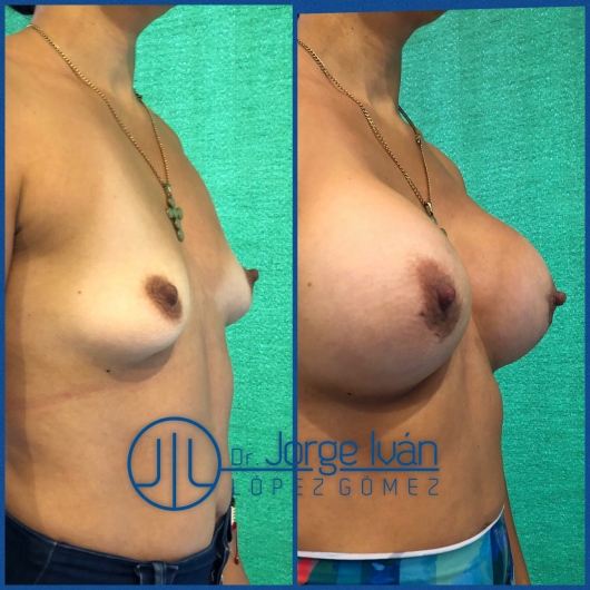 Jorge Iván López Gómez-12