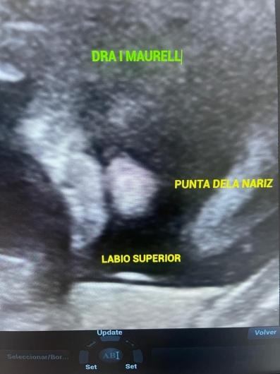 Igorly Maurell Ospina-11