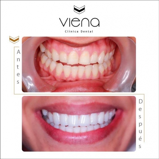 Sara Peláez Monsalve-3