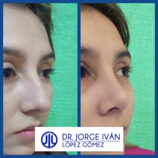 Jorge Iván López Gómez-20