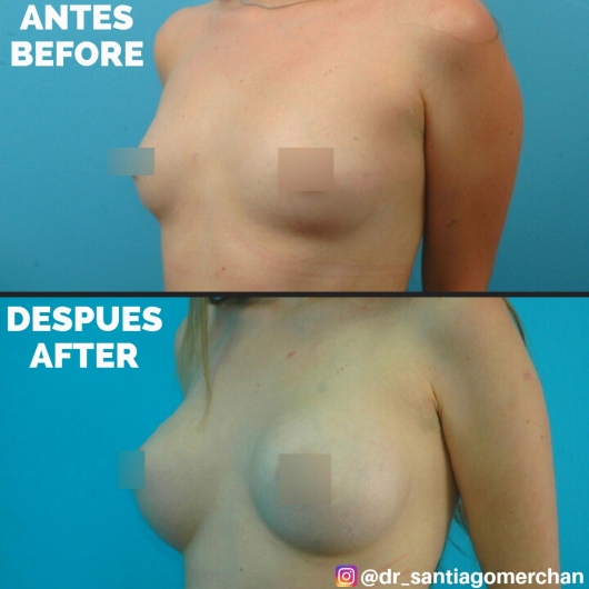 Santiago Merchan Cadavid-1