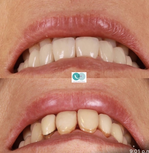 Eva Luz Quintero Giraldo-5