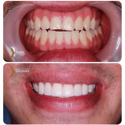 Sara Peláez Monsalve-1