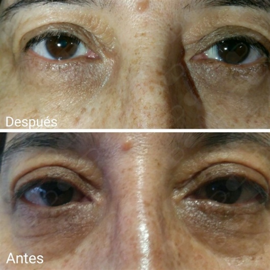 Julián Guerrero Almeida-4