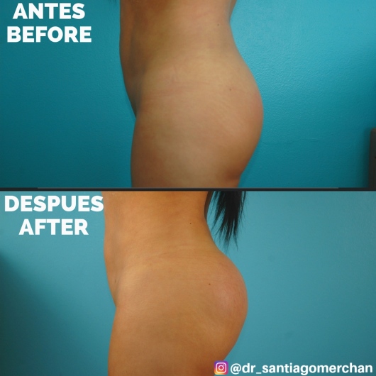 Santiago Merchan Cadavid-2