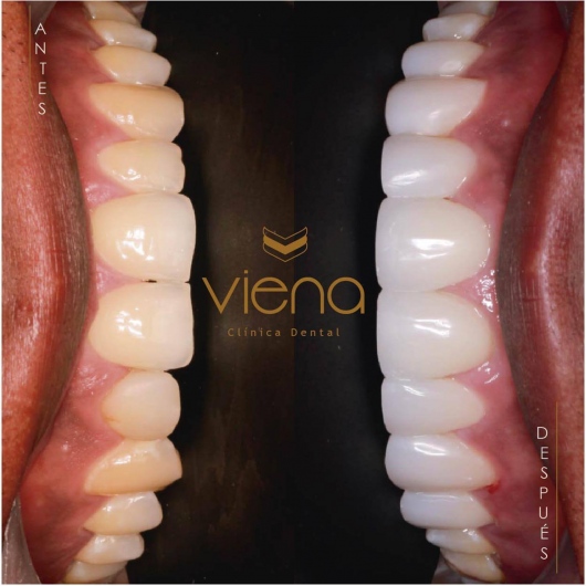 Sara Peláez Monsalve-2