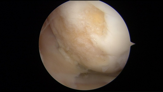 Josué Calderón Gamba-18