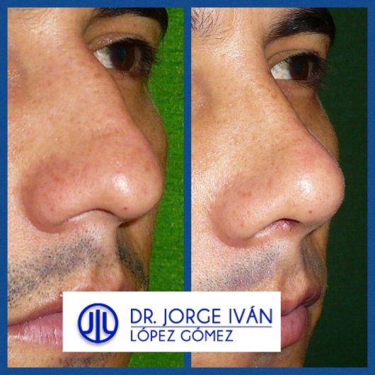 Jorge Iván López Gómez-29