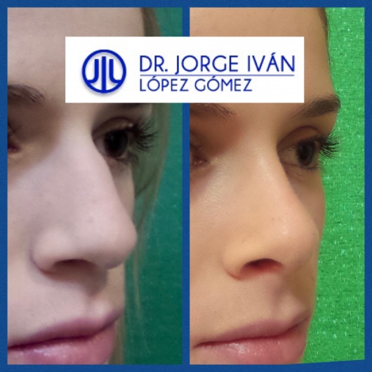 Jorge Iván López Gómez-24