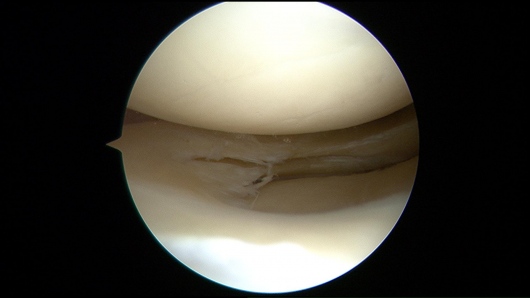 Josué Calderón Gamba-19