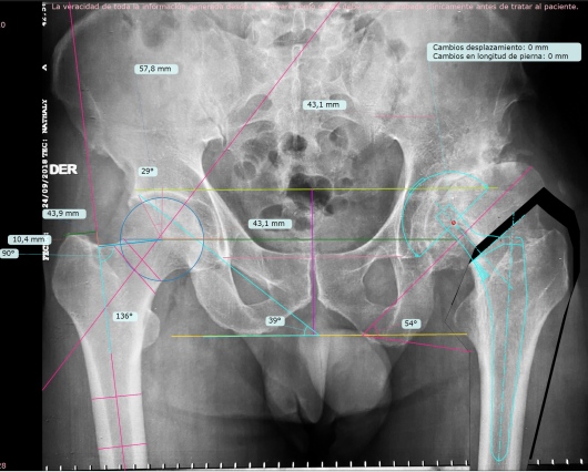 Josué Calderón Gamba-15