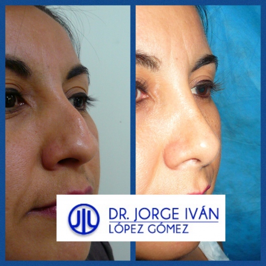 Jorge Iván López Gómez-21