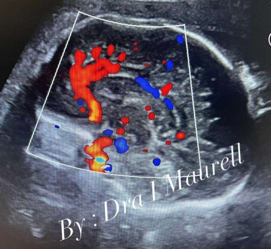Igorly Maurell Ospina-9