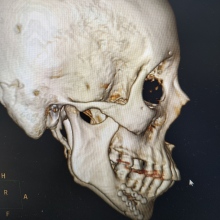 Acercar imagen: Cristian Parra Molina, Cirujano maxilofacial Agustin Codazzi