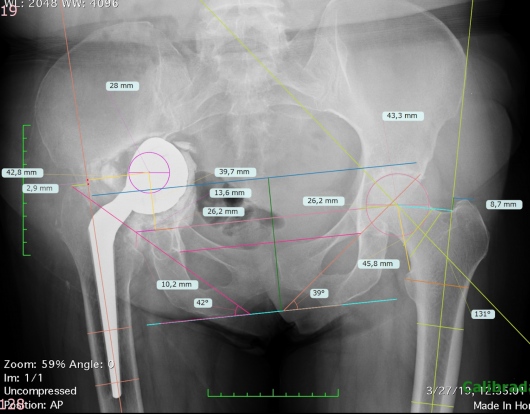 Josué Calderón Gamba-17