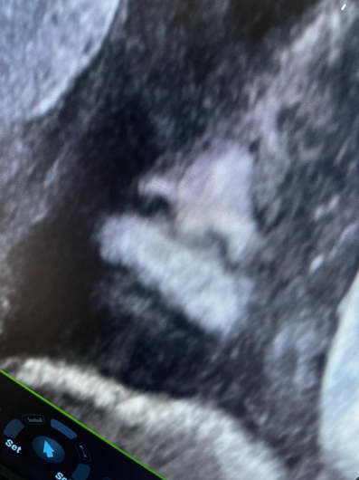 Igorly Maurell Ospina-12