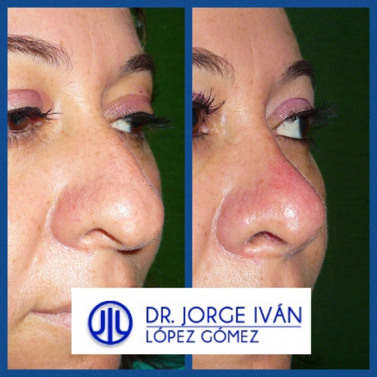 Jorge Iván López Gómez-23