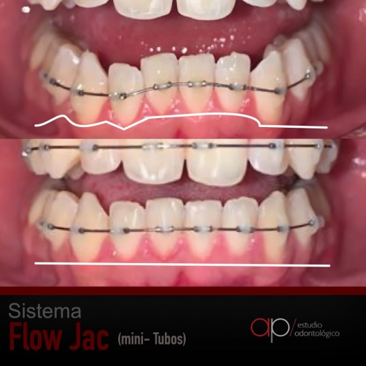 Ramsés Leonardo Ardila Avendaño-4