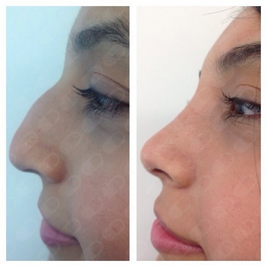 Nidia Patricia Mejía Giraldo-23