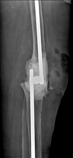 Josué Calderón Gamba-23