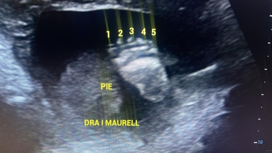 Igorly Maurell Ospina-1