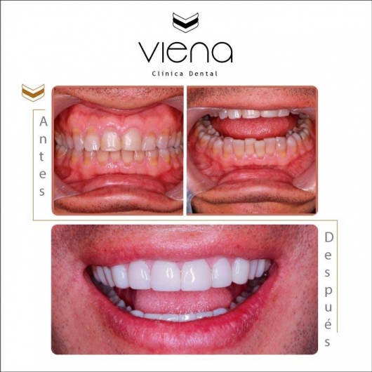 Sara Peláez Monsalve-4