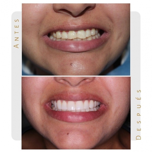 Sara Peláez Monsalve-0