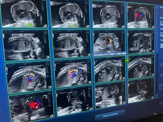 Igorly Maurell Ospina-7