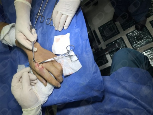 Paulo Antonio Alban Pulgarin-9