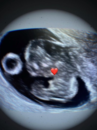 Igorly Maurell Ospina-2