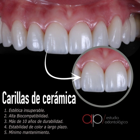 Ramsés Leonardo Ardila Avendaño-3