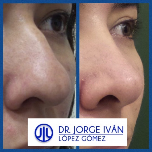 Jorge Iván López Gómez-28