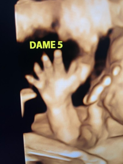 Igorly Maurell Ospina-5