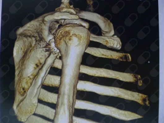 Andres De La Espriella Rosales-58