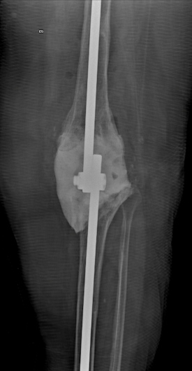 Josué Calderón Gamba-24