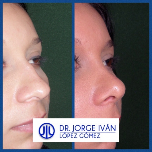 Jorge Iván López Gómez-19