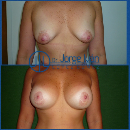 Jorge Iván López Gómez-15