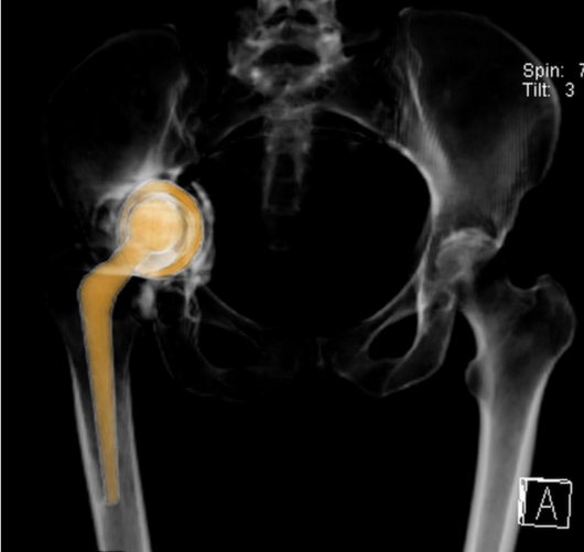 Josué Calderón Gamba-16