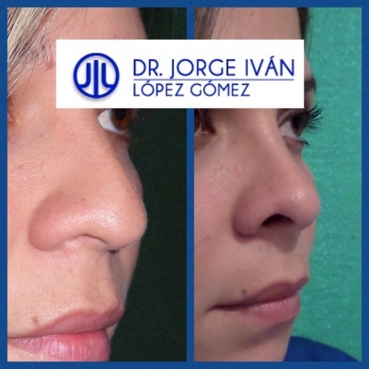 Jorge Iván López Gómez-25