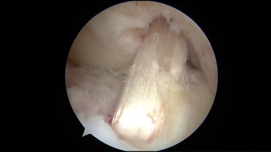 Josué Calderón Gamba-13