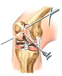 Ulbiramar Correia-11
