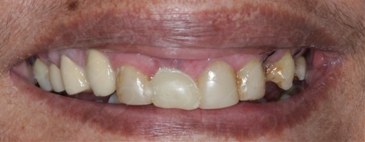 Antônio Alegria Do Nascimento-17