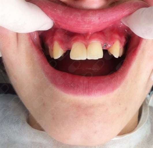 Rosangela Polonio Lopes-3